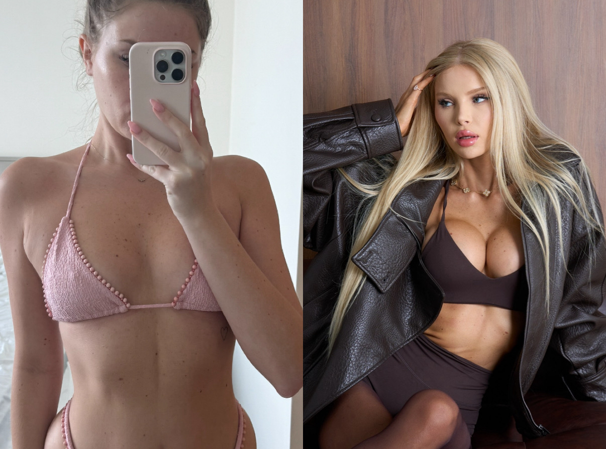 before after breasts