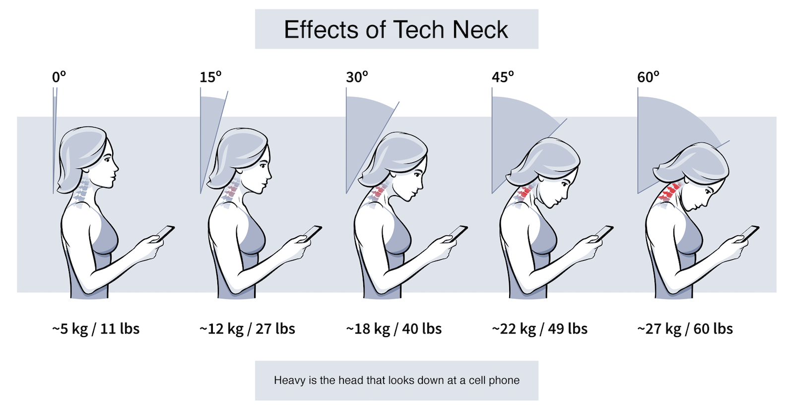 Effects of Tech Neck