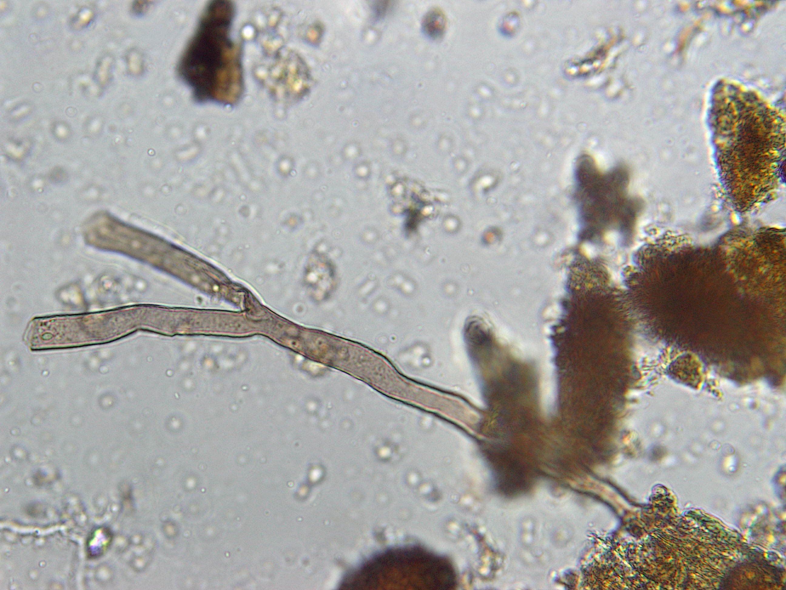Image of a soil fungus 400 X total magnification.