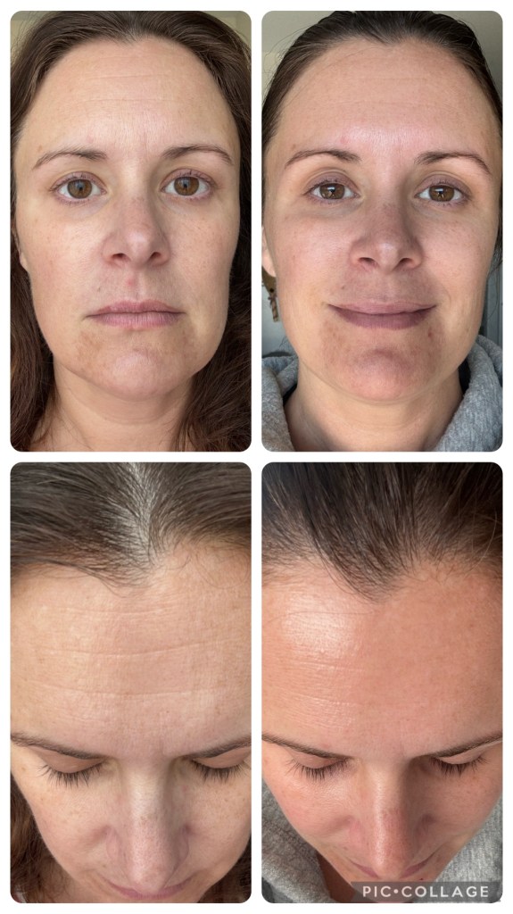 before and after results showing reduction of physical perimenapause issues