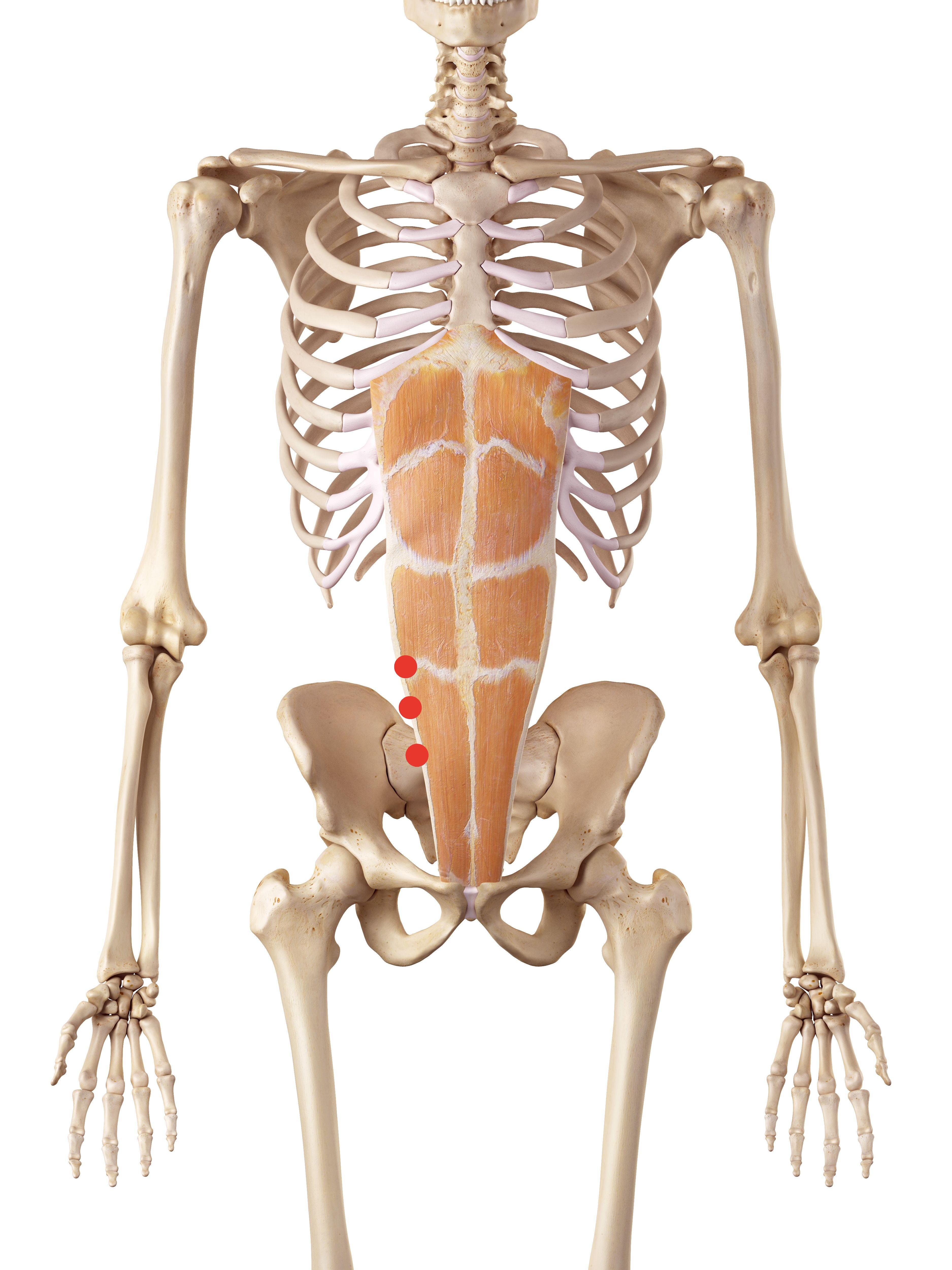 Psoas through rectus abdominis fibers