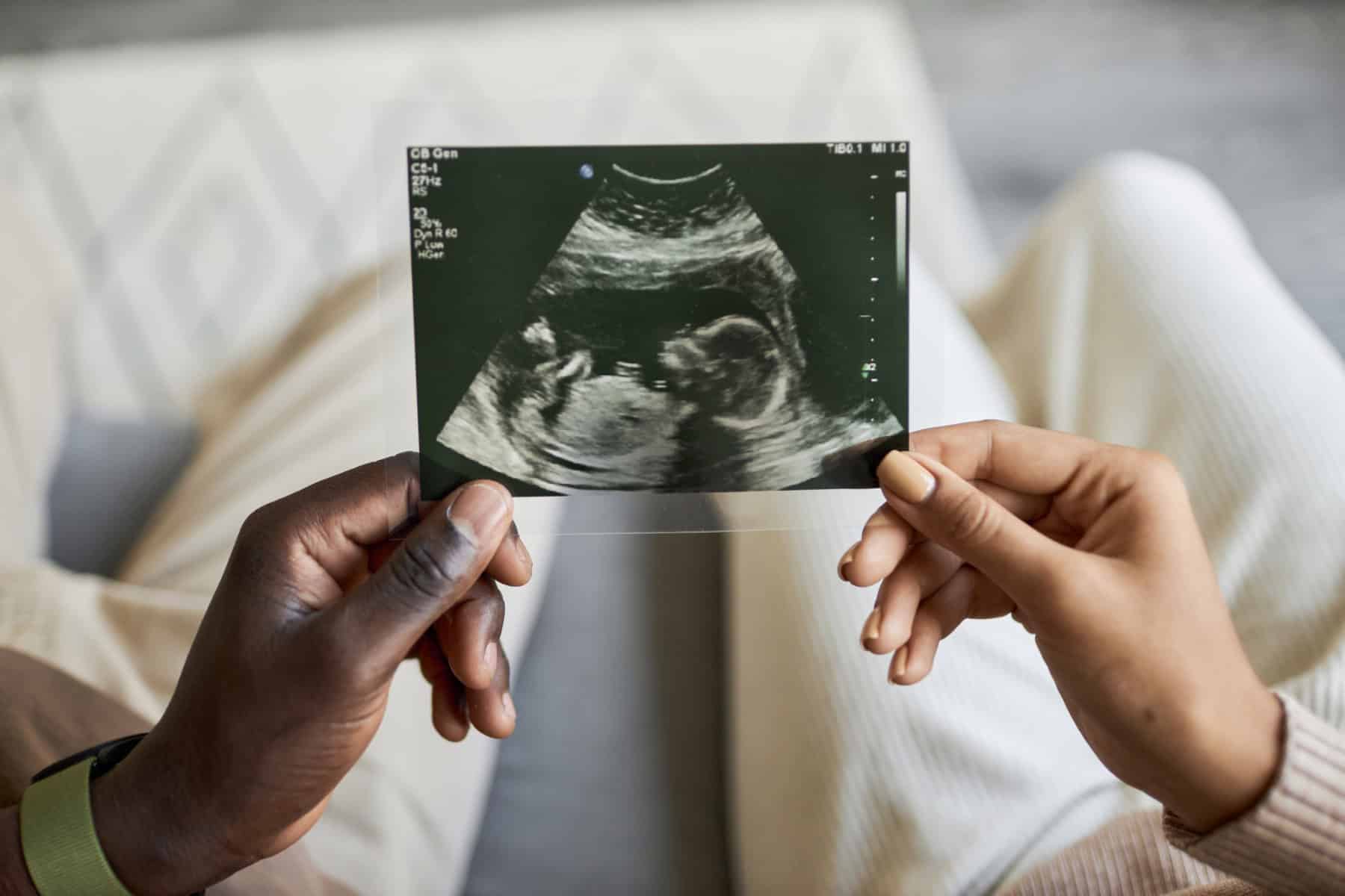 12 Steps To Survive The Wait For The 12 Week Ultrasound