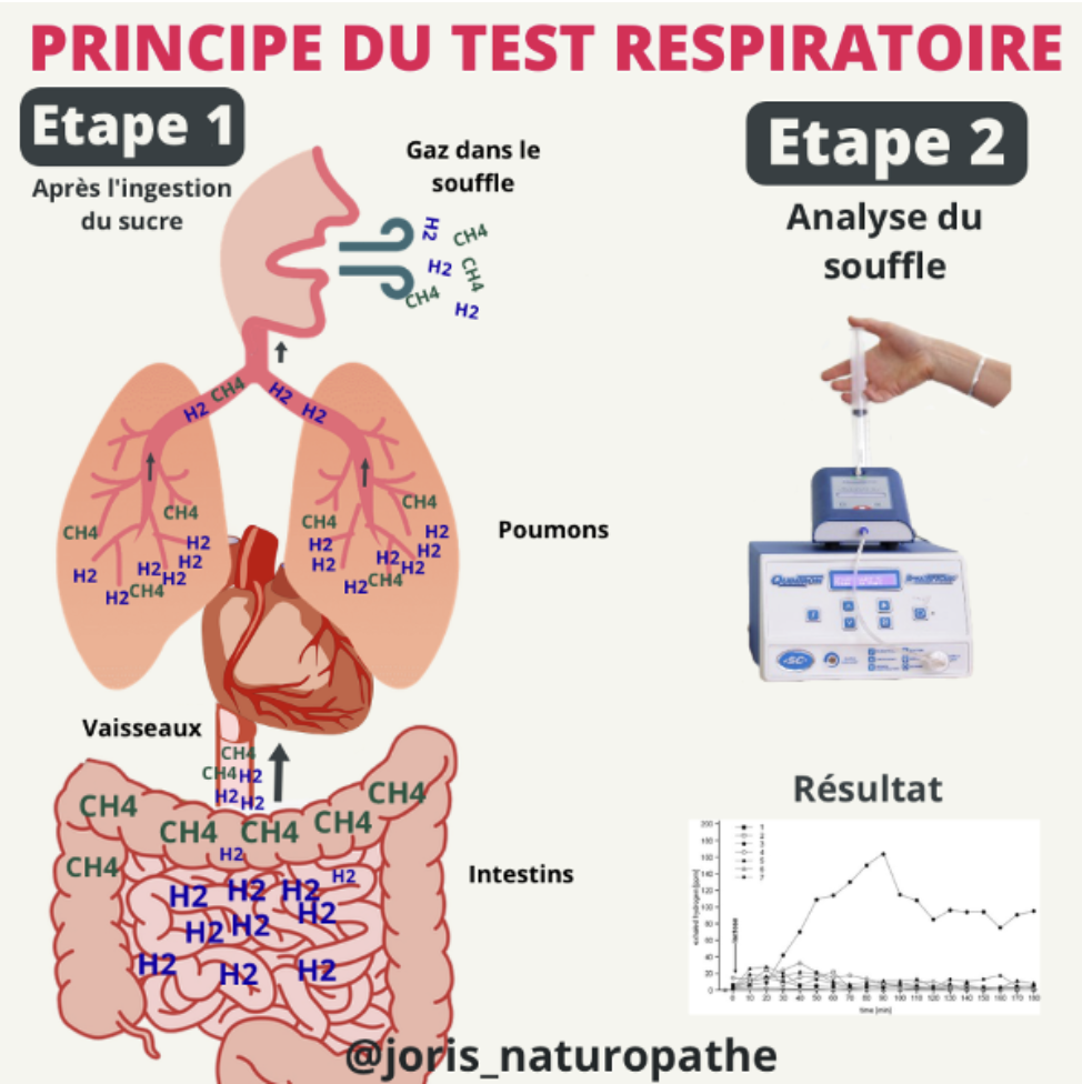 test respiratoire sibo