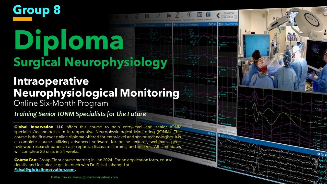 Purple stage lighting