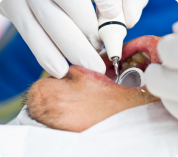 Uso do fio dental