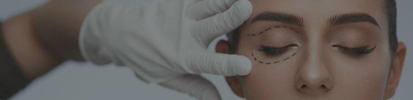 Blefaroplastia