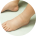 Edemas