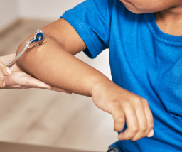 Epilepsia en niños