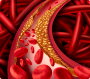 Hipertensión arterial primaria