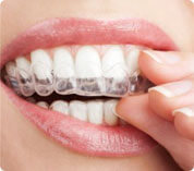 Blanqueamiento dental