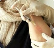 Terapia biológica