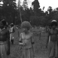 Dobodura Natives, Albino Man