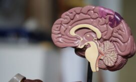 A detailed anatomical model of a human brain is displayed on a stand. It showcases the brain's internal structures, with a blurred background indicating an indoor setting.