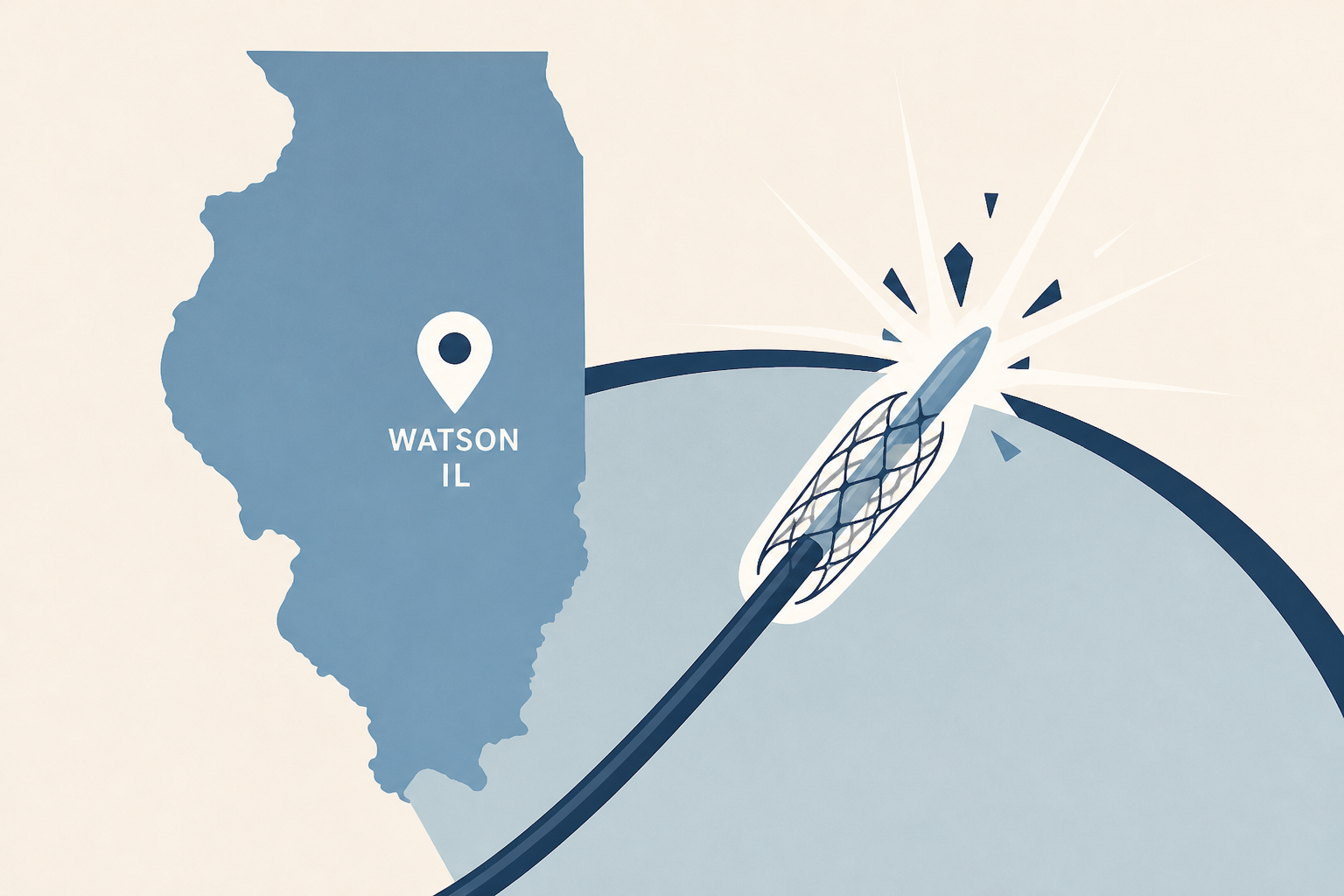 Watson IL woman undergoes groundbreaking procedure
