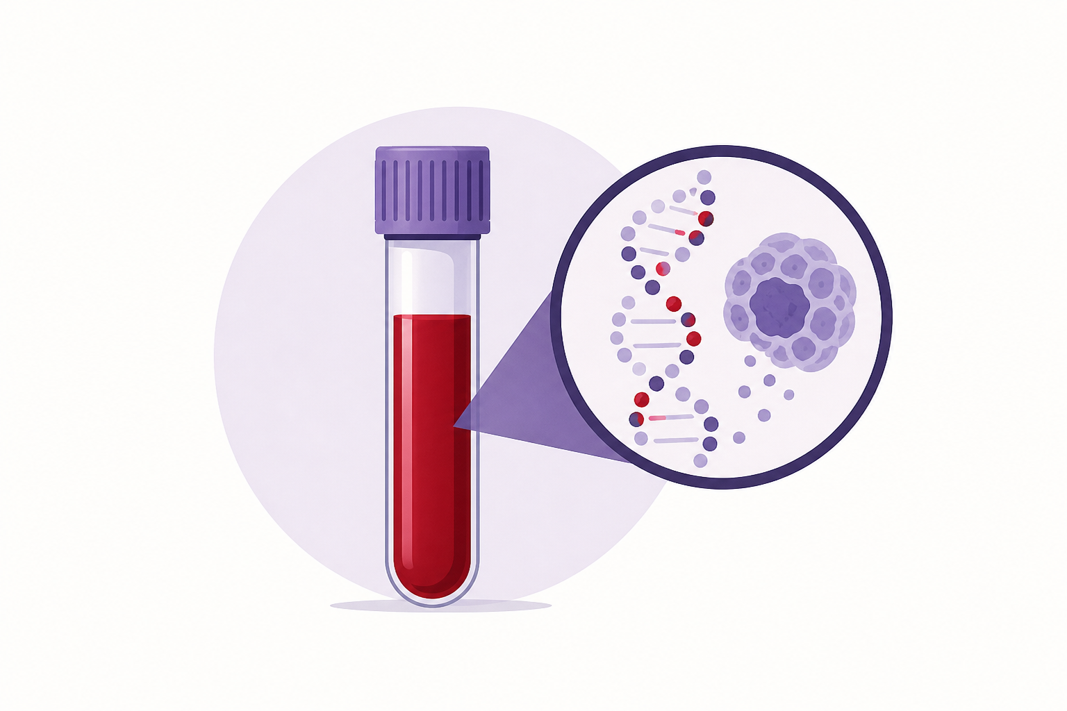 Blood tests could transform cancer screening soon : NPR