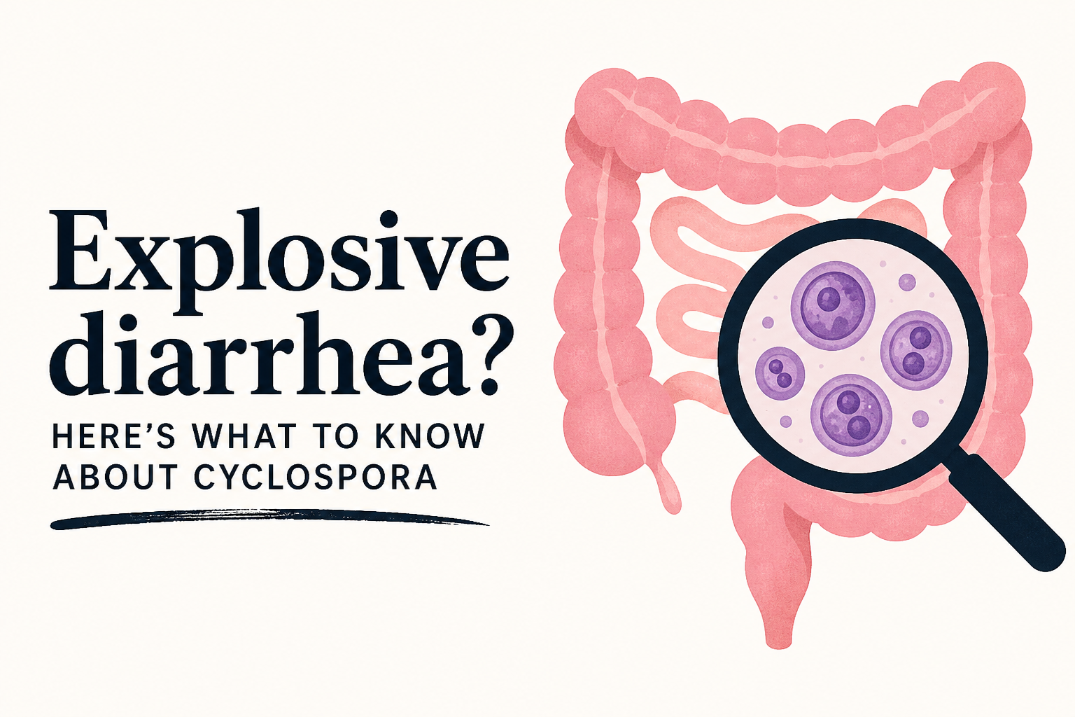 Explosive diarrhea? Here's what to know about Cyclospora