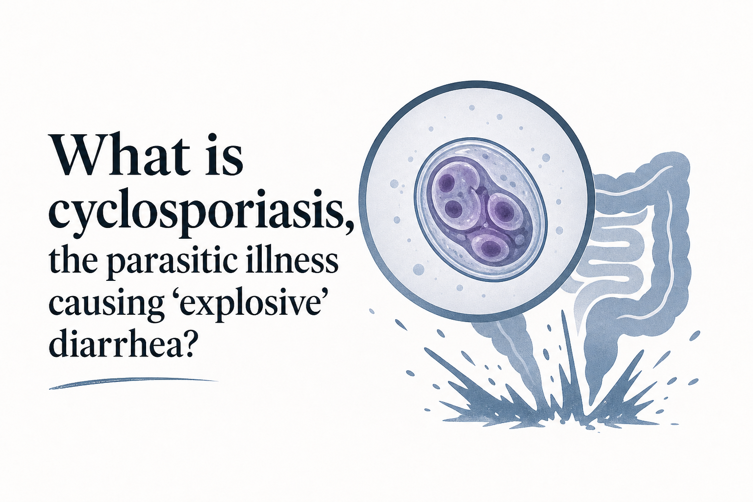 What is cyclosporiasis, the parasitic illness causing ‘explosive’ diarrhea?