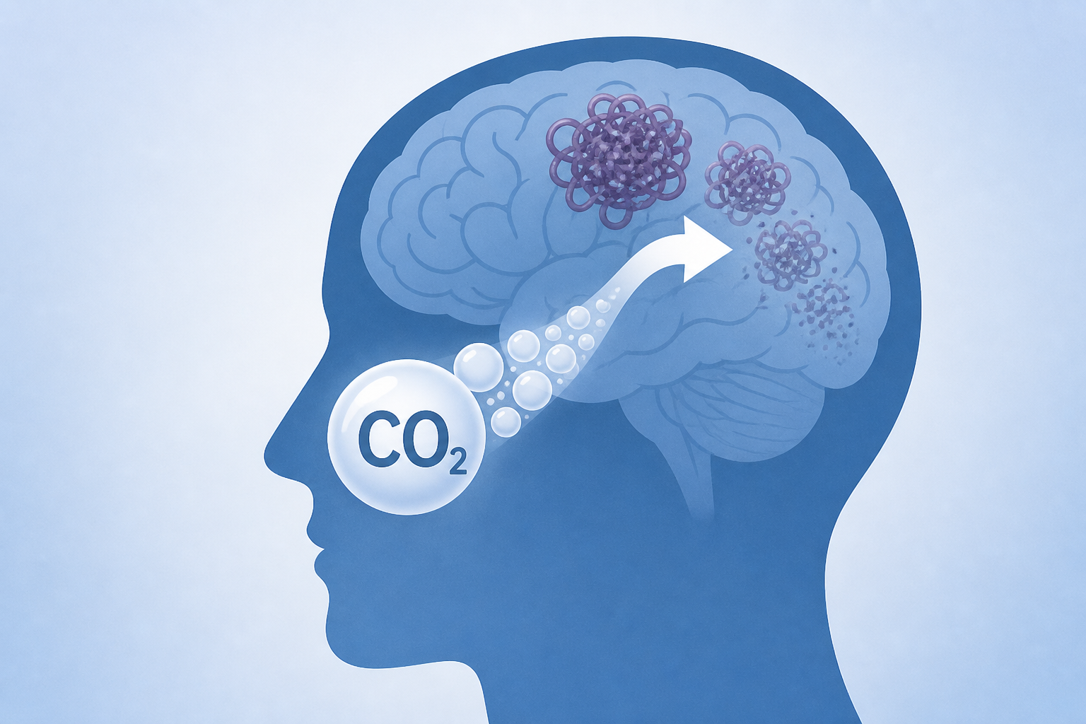 CO2 Treatments May Clear Alzheimer's Proteins From The Brain