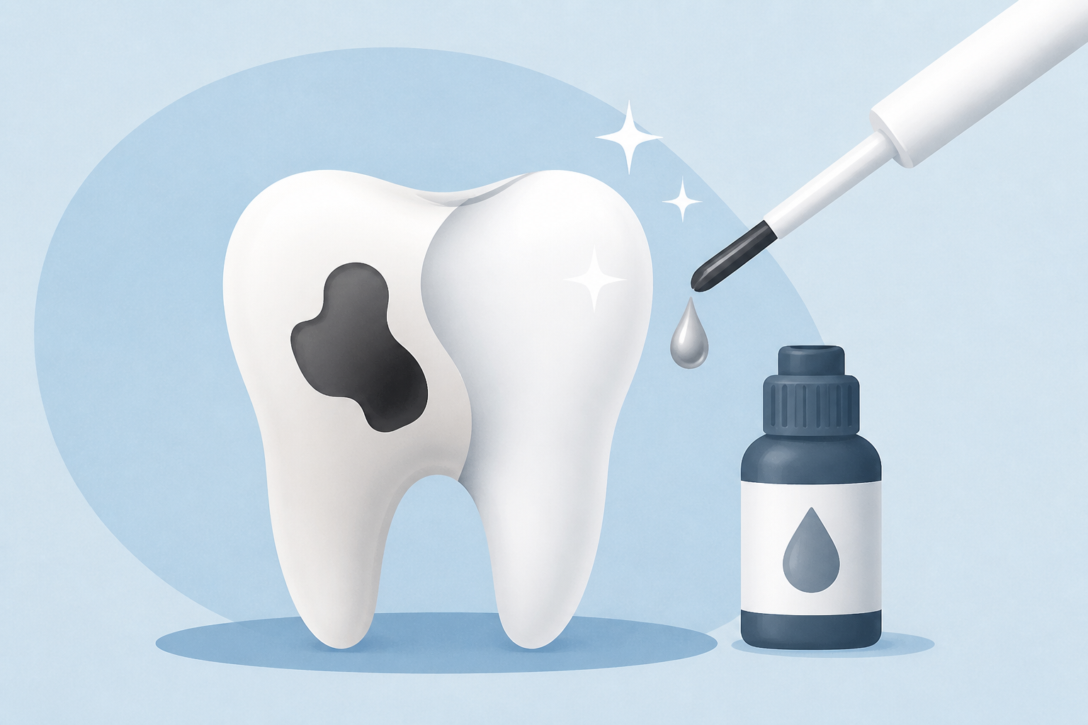 Silver diamine fluoride treatment could halt cavities without shots, drilling or sedation
