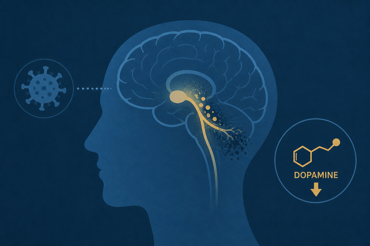 Long COVID symptoms linked to measurable damage in the brain's dopamine system