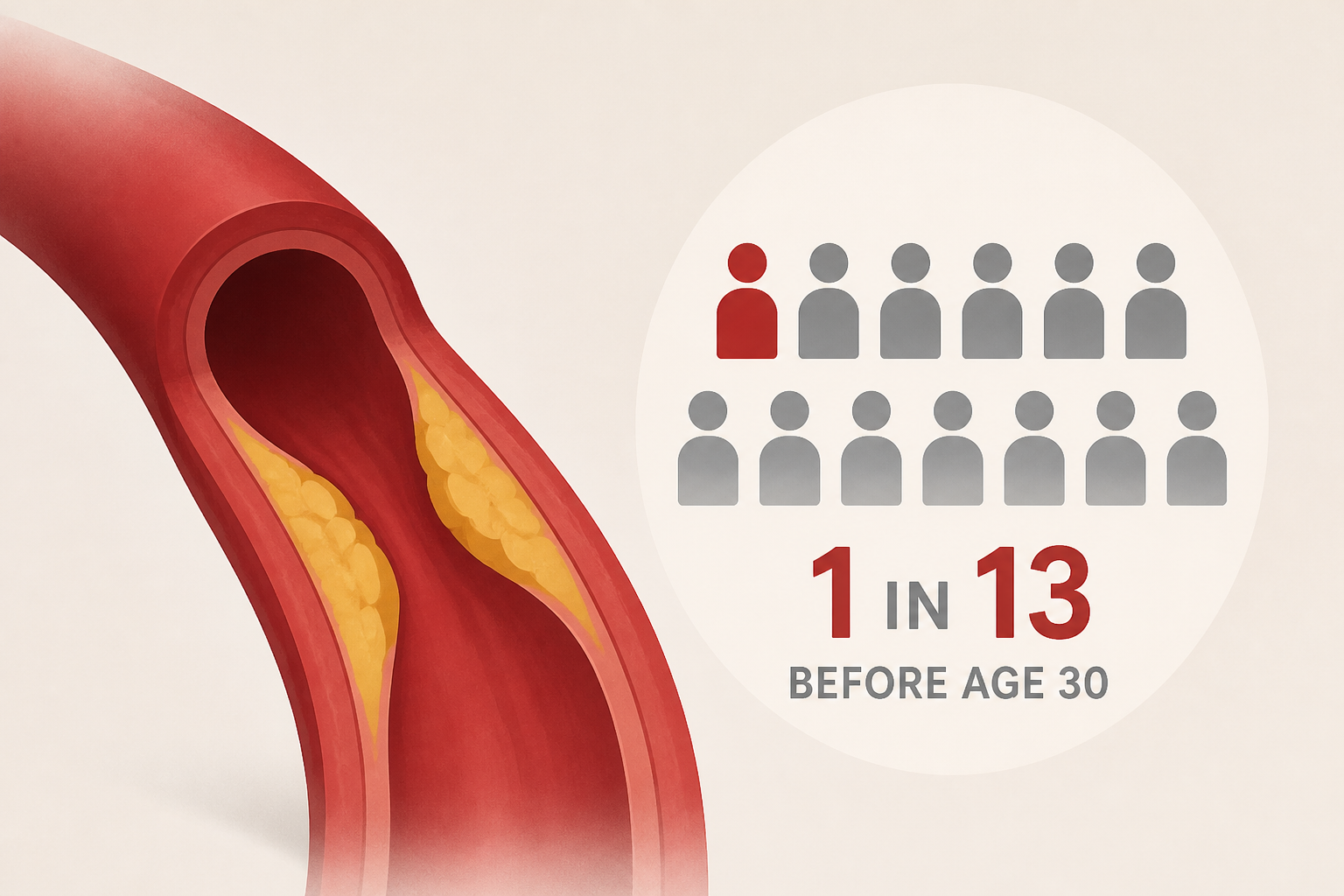 Silent artery plaques may appear in one in 13 adults before age 30