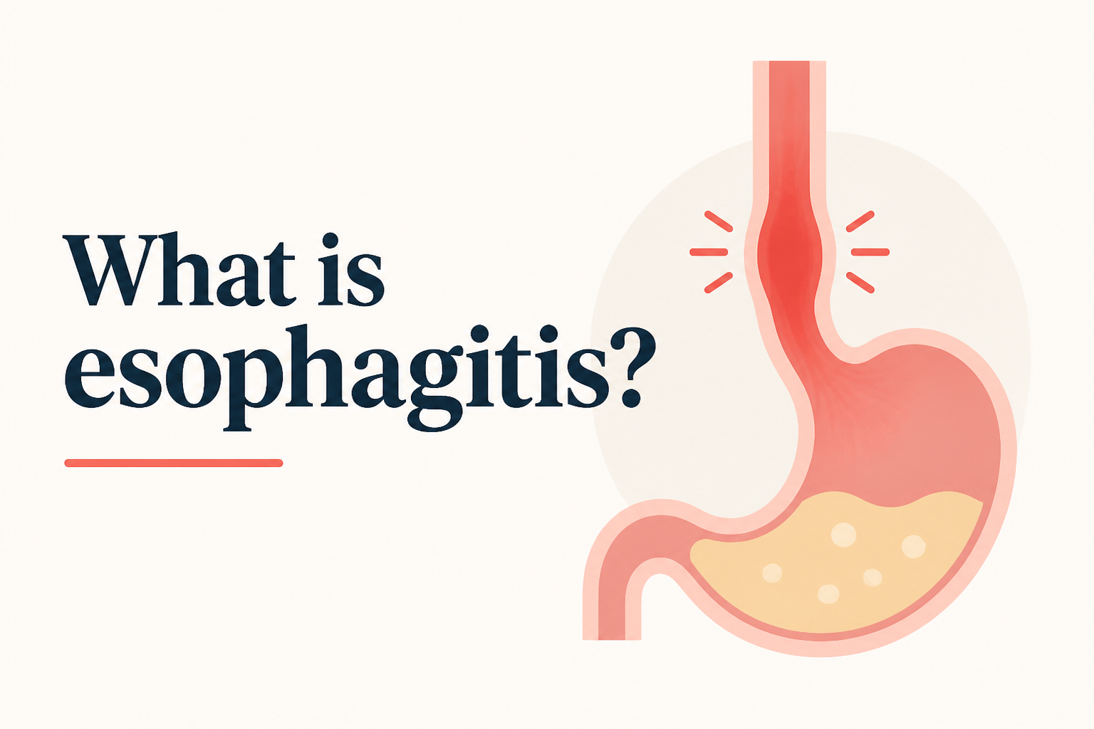 What is esophagitis?