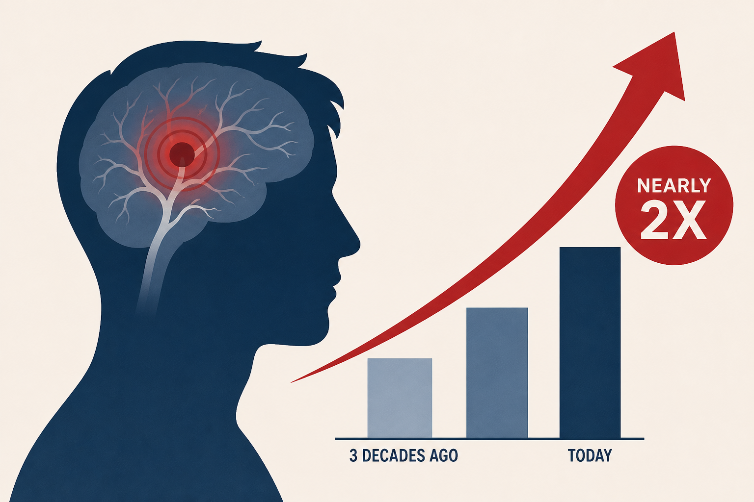 Stroke rates among young adults nearly doubled in 3 decades