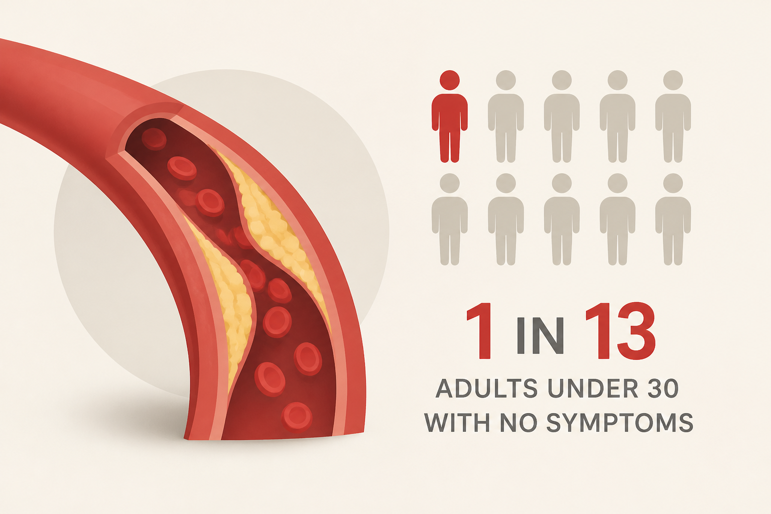 Study finds artery plaque in 1 in 13 adults under 30 with no symptoms
