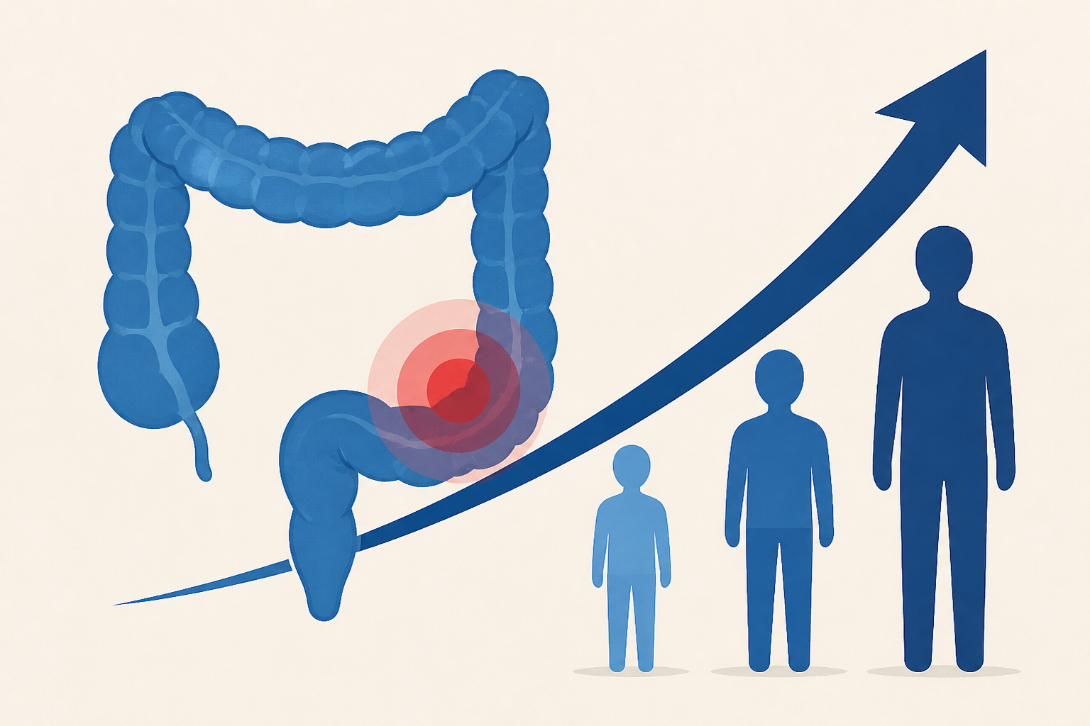 Colon cancer deaths rise as patients get younger