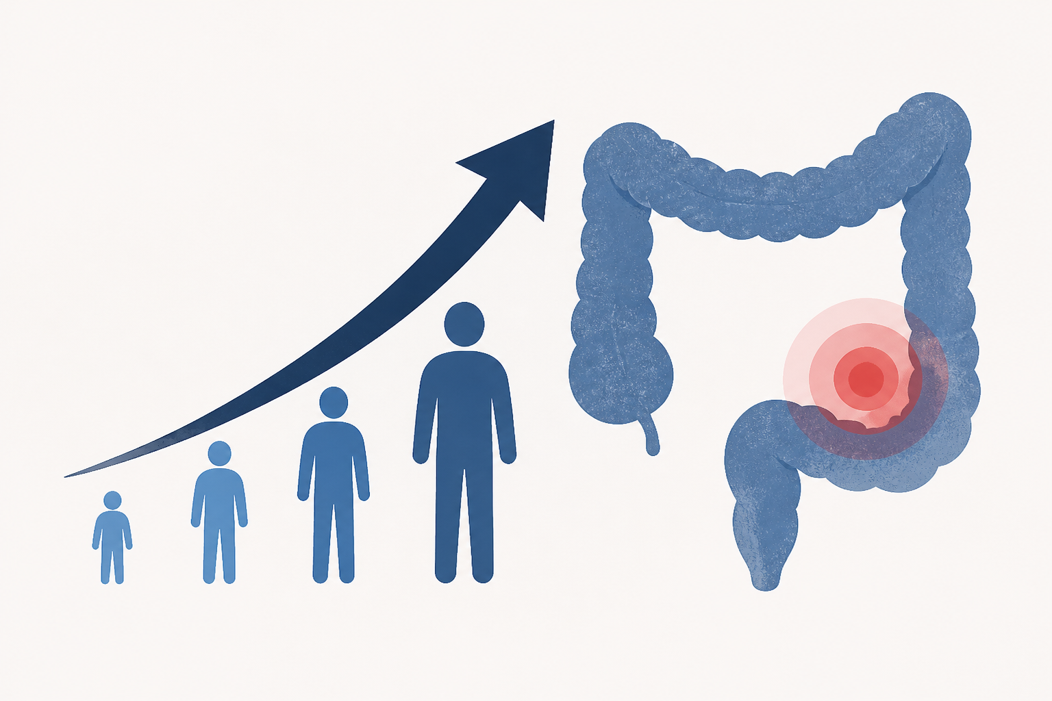 Colon cancer deaths rise as patients get younger