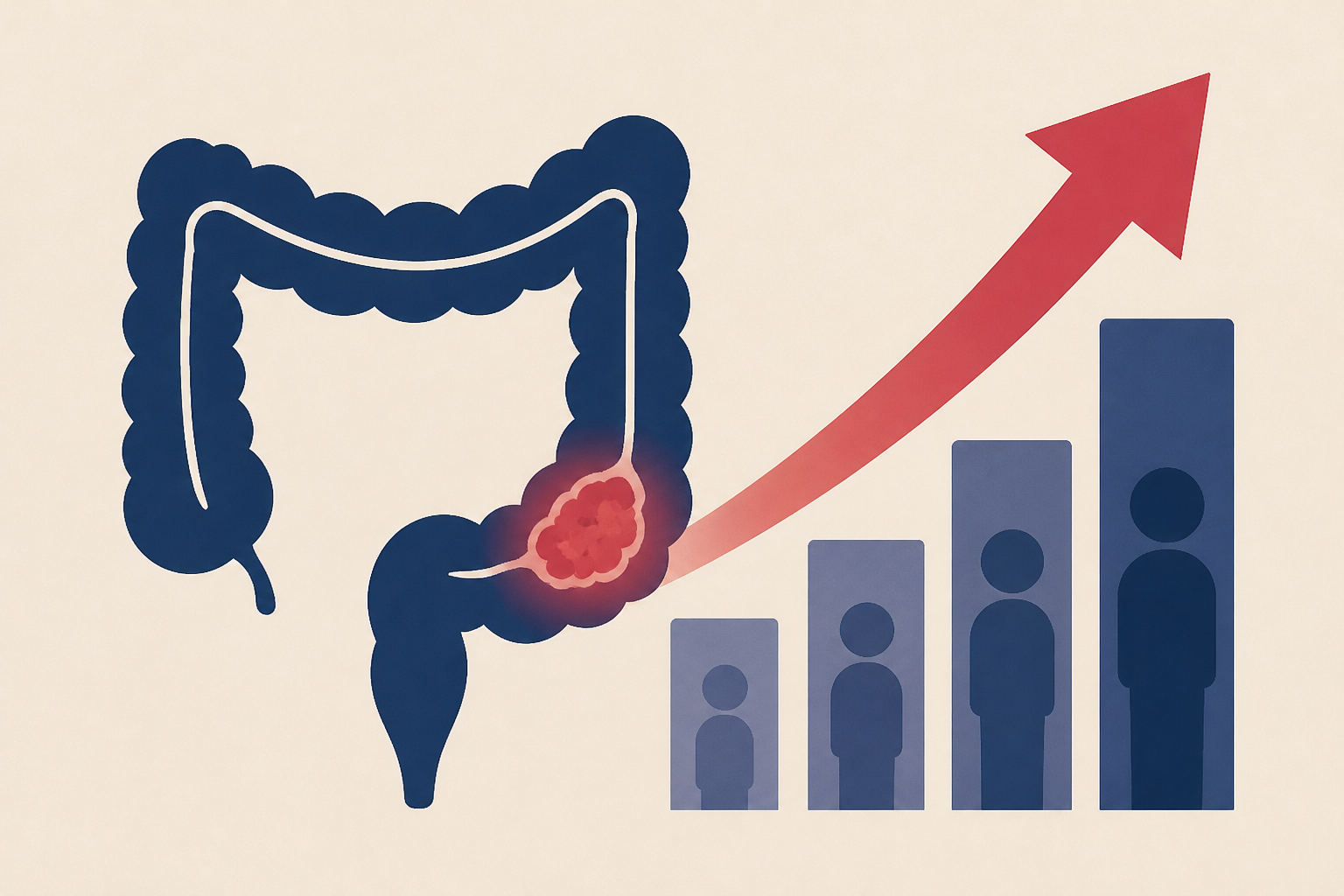 Colon cancer deaths rise as patients get younger