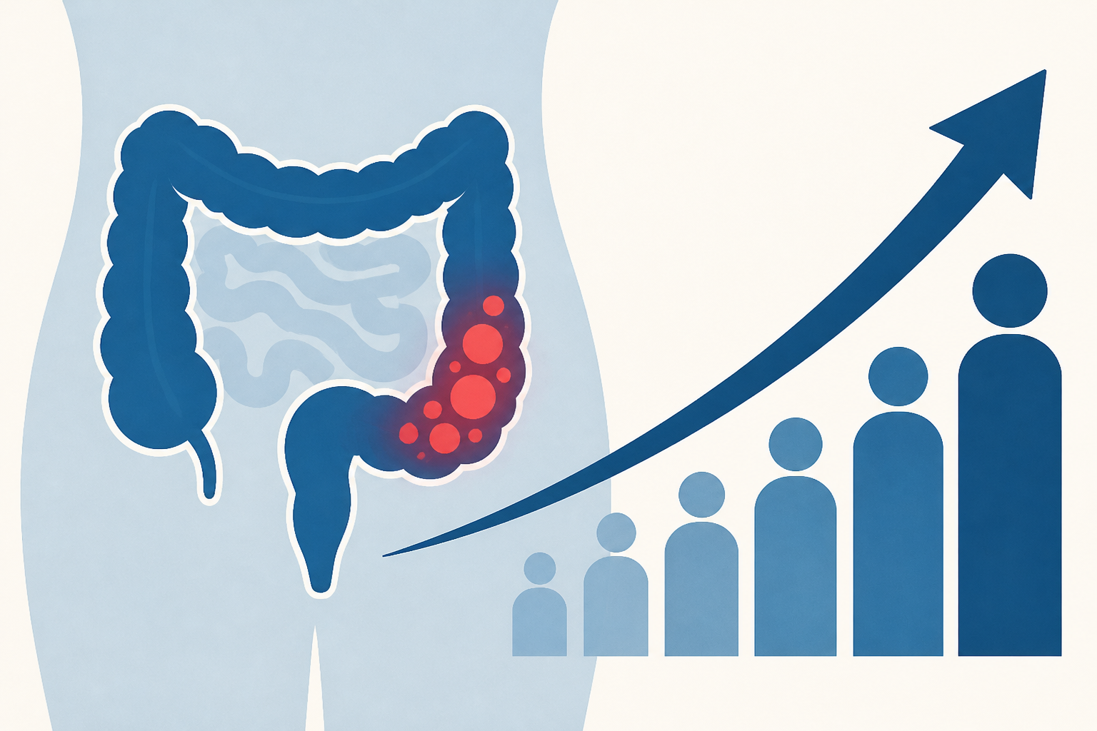 Colon cancer deaths rise as patients get younger