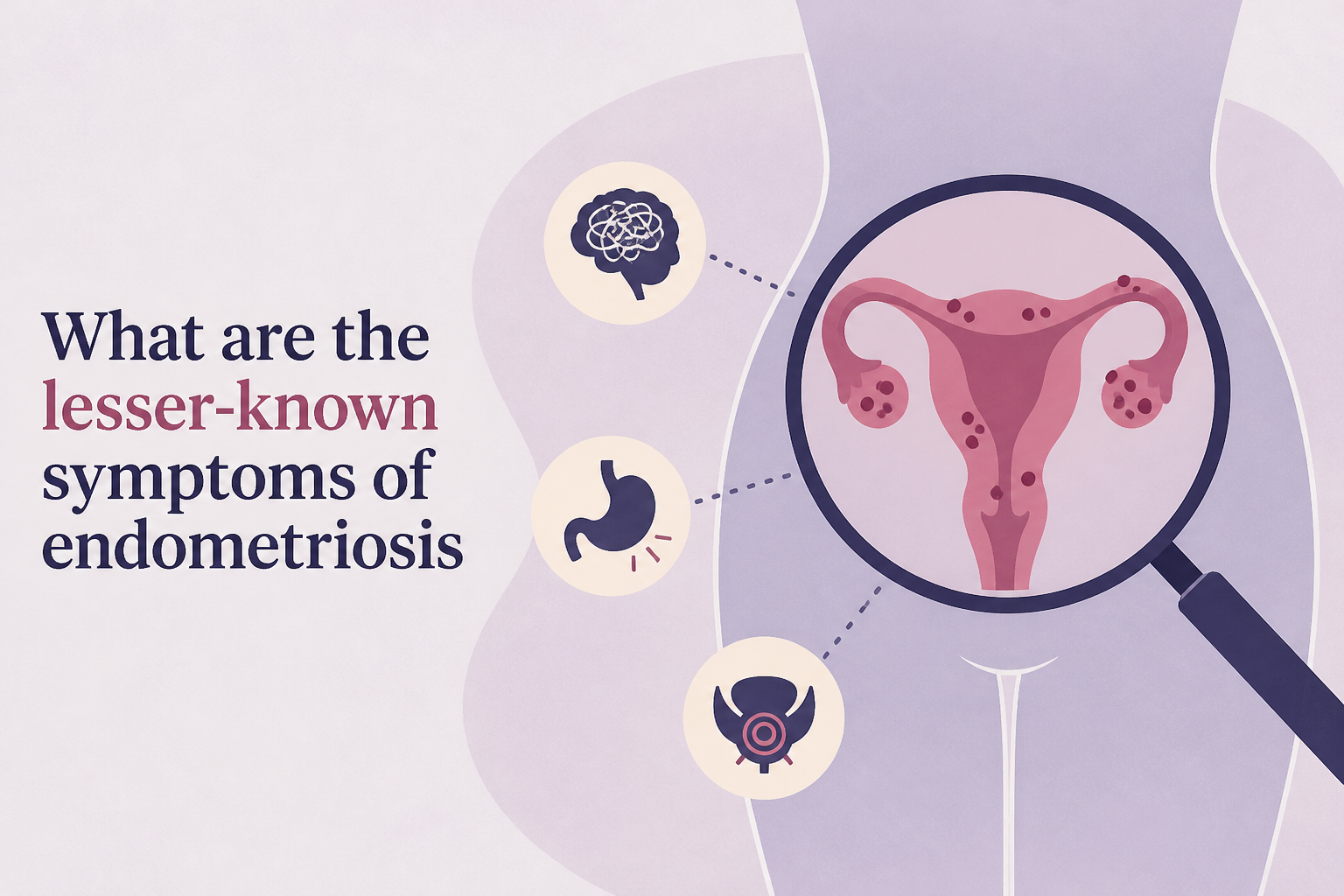 What are the lesser-known symptoms of endometriosis