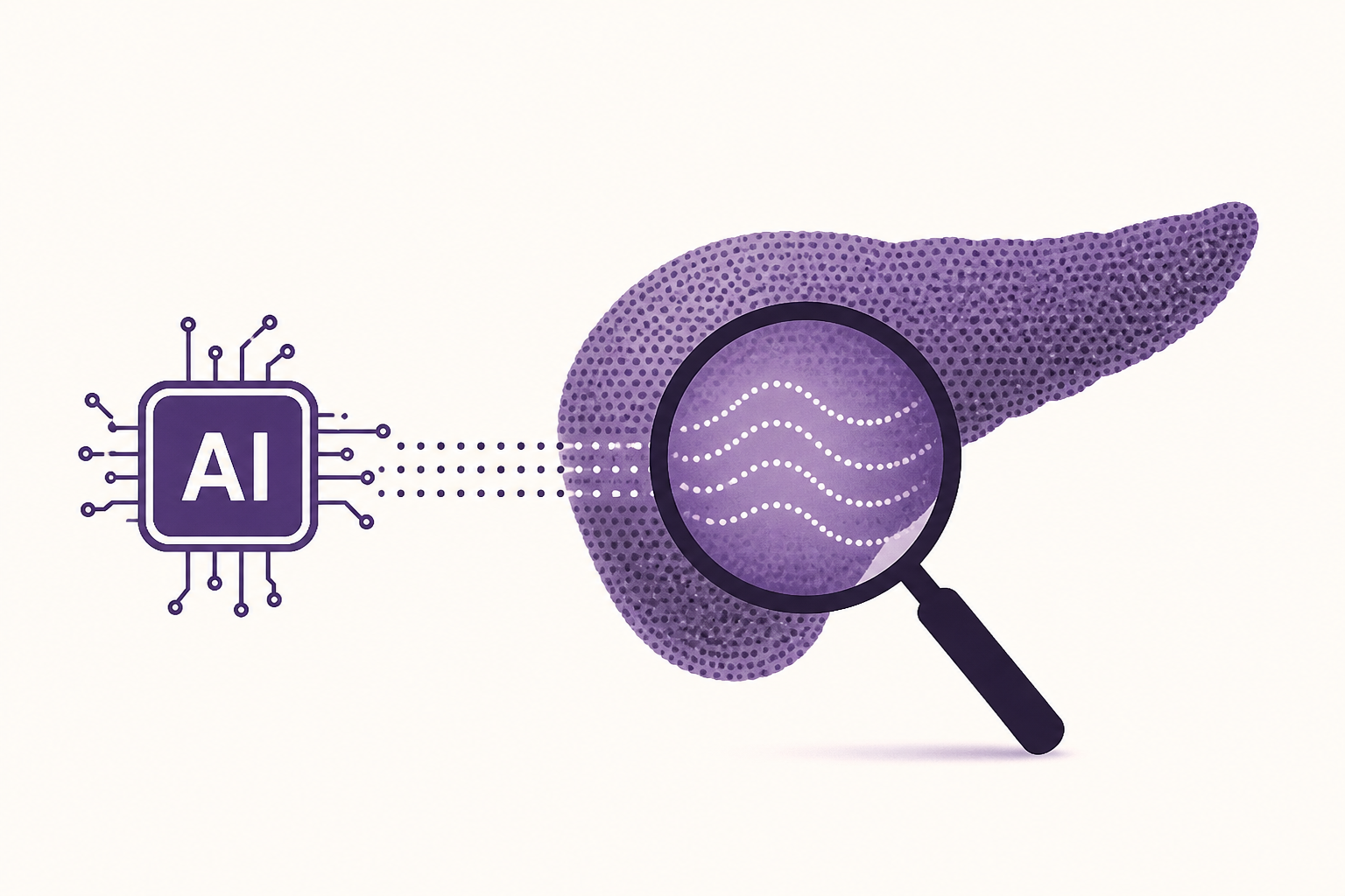 AI detects “invisible” signs of pancreatic cancer years before diagnosis