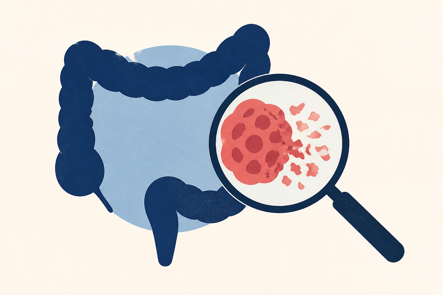 Why is colorectal cancer aggressive in younger patients? Boston researchers discover new clues