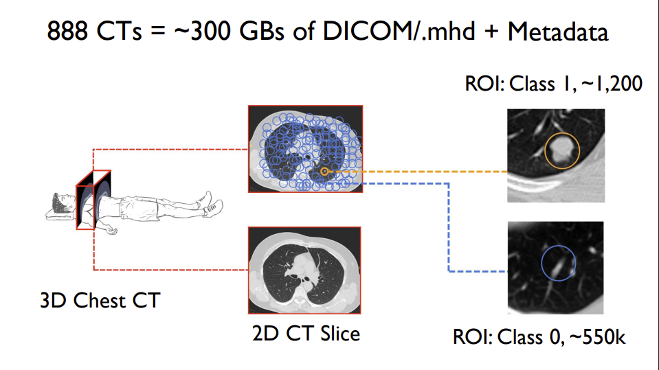 ROI with cancerous nodule