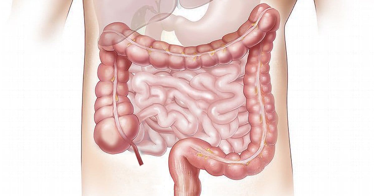 Cannabis Use Disorder And Colon Cancer Outcomes