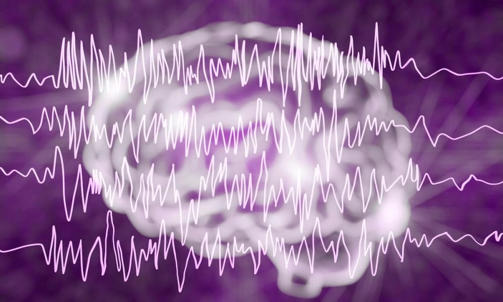 Medical Cannabis Linked to Improvements in Treatment-Resistant Epilepsy