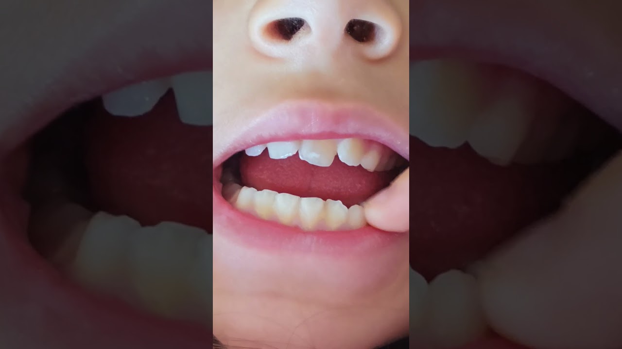 5dqsss Marijuana how do you know so