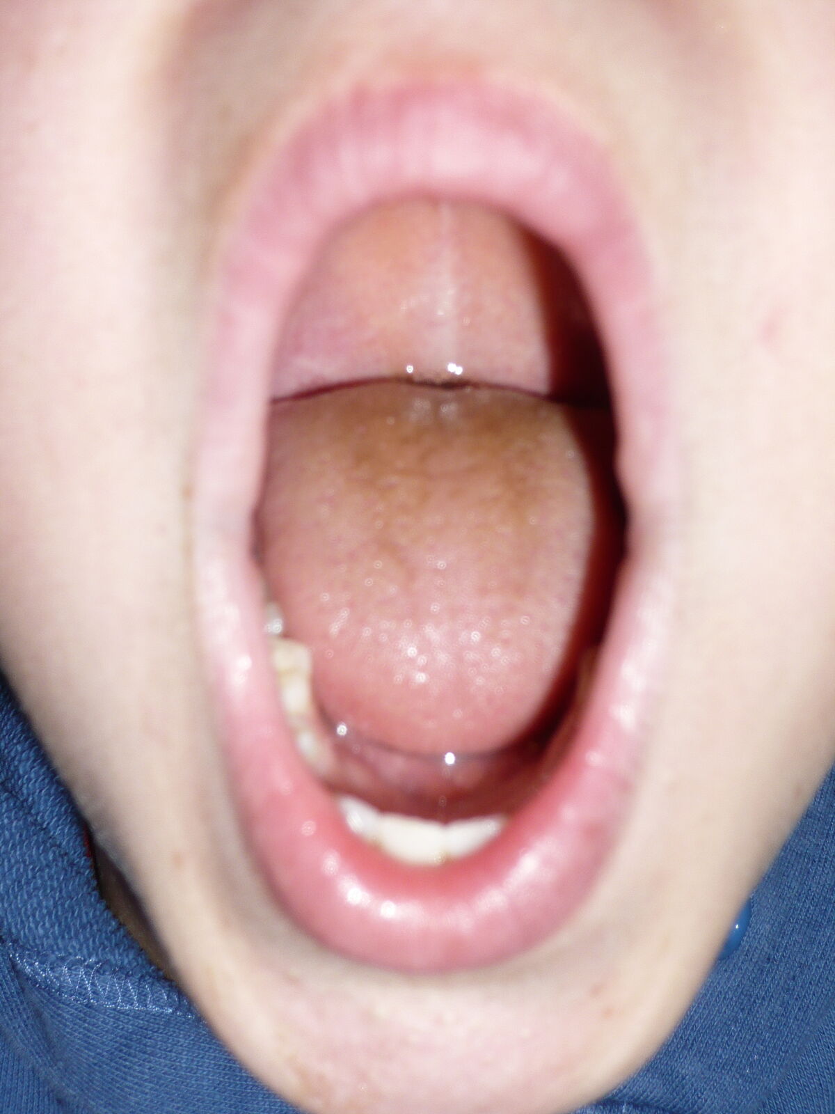 21