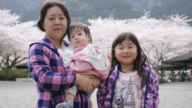 ¿Por qué las cesáreas en Japón y otros países asiáticos suelen ser verticales en vez de horizontales?