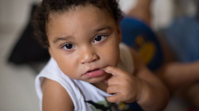 Brasil: el bebé nacido con microcefalia por el zika que los médicos consideraron un caso perdido pero que tiene un desarrollo sorprendente