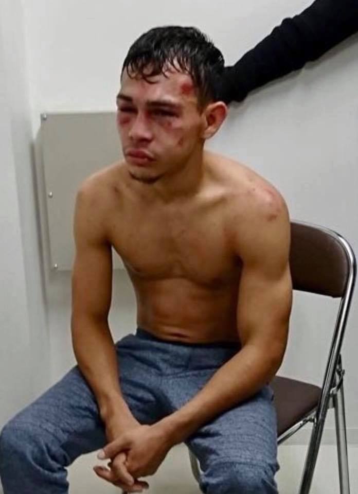 Carlos Buitrago terminó noqueado ante Hiroto Kyoguchi