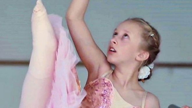 La inspiradora historia de una niña que perdió una pierna a los 2 años y cumplió su sueño de convertirse en bailarina