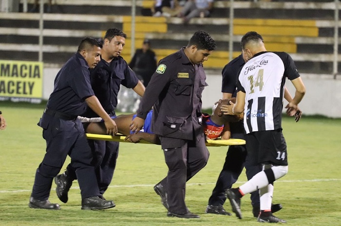 La proyección de Anderson Treminio frenada por fractura de tibia