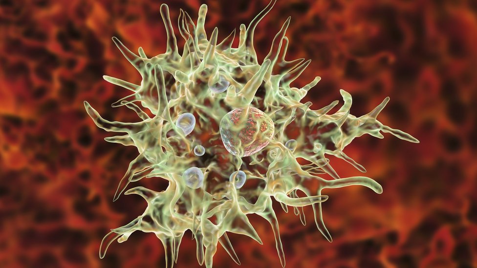 Qué es la ameba «come cerebros» y cómo puedes evitar que te contagie