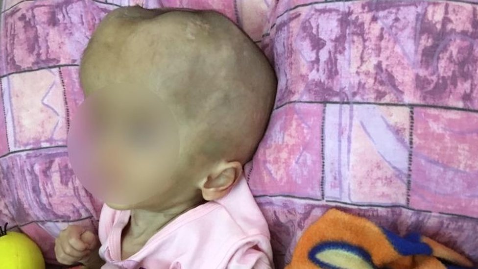 La interminable batalla de una madre en Venezuela para salvar a su hija enferma y desnutrida (y lo que revela sobre la crisis del país)