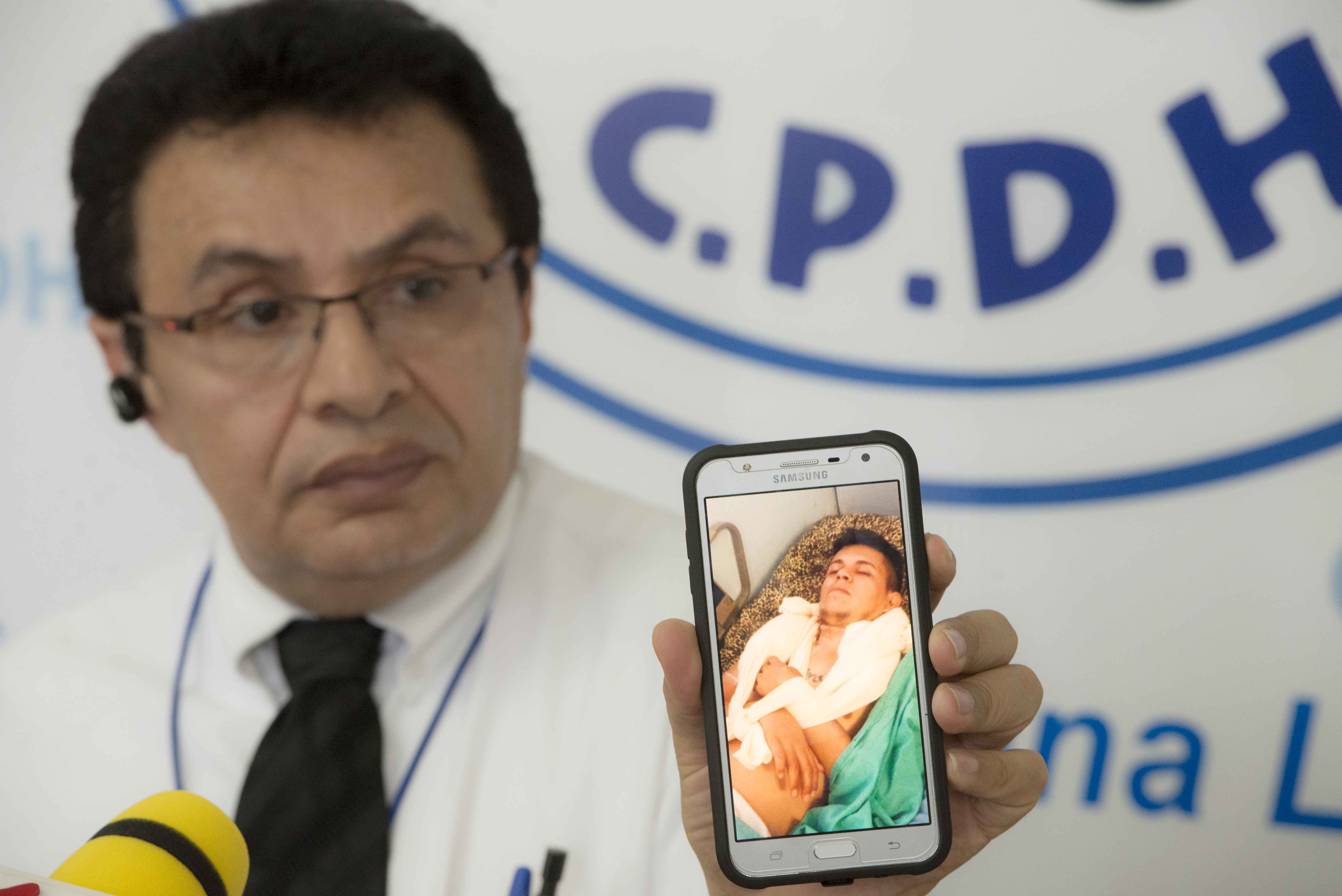 Un joven que apenas camina es acusado de terrorista en Nicaragua