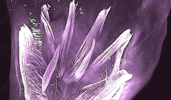 Las extrañas manos de reptil que tienen los fetos humanos durante la gestación