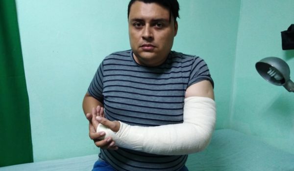 Periodista resulta con un brazo fracturado tras agresión de la Policía Orteguista